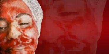 beykozlu-kadin-guzellik-merkezinde-k_bus-yasadi_8243-1