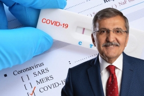 isbeykoz-belediye-baskani-murat-aydin-koronaviruse-y_4250-1