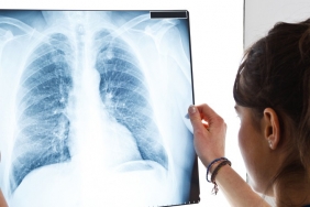 isbeykoz-da-erken-teshisin-onemi-vurgulandi_5288-1