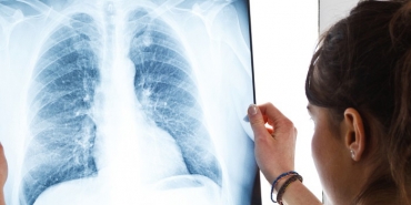 isbeykoz-da-erken-teshisin-onemi-vurgulandi_5288-1