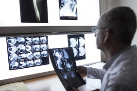 isbeykoz-ilce-saglik-uyardi-radyasyon-en-buyuk-risk_3534-4