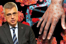 Sağlık Bakanlığı'ndan maymun çiçeği (MPOX) rehberi (6)