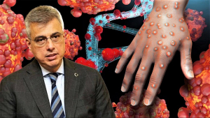 Sağlık Bakanlığı'ndan maymun çiçeği (MPOX) rehberi (6)