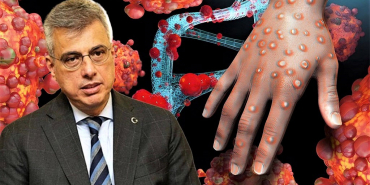 Sağlık Bakanlığı'ndan maymun çiçeği (MPOX) rehberi (6)