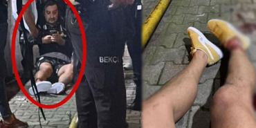 fenerbahceli-eski-futbolcu-beykozda-saldiriya-ugradi