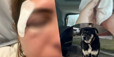 beykozda-bir-sokak-kopegi-saldirisi-daha