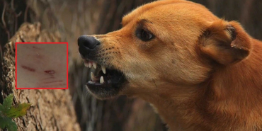 beykozda-kopek-dehseti-kucuk-cocuga-saldirdilar